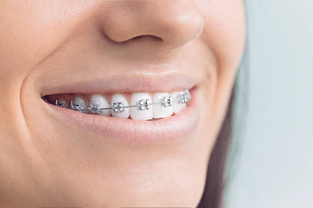 Best Teeth Whitening  in San Francisco, CA